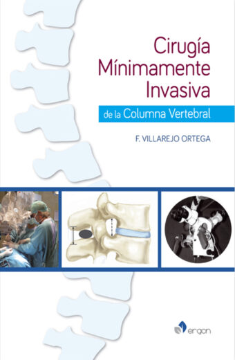 Cirugía Mínimamente Invasiva de la Columna Vertebral