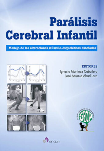 Parálisis Cerebral Infantil