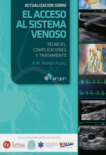 Actualizacion Acceso al Sistema Venoso