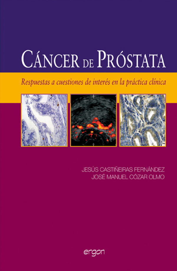 Cancer de Prostata