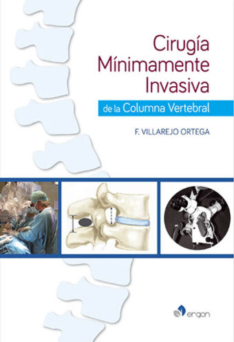 Cirugía Mínimamente Invasiva de la Columna Vertebral