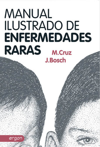 Manual Ilustrado de Enfermedades Raras
