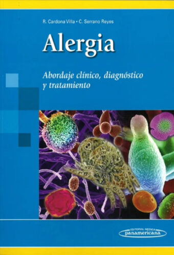 Alergia - Abordaje clínico, diagnóstico y tratamiento.